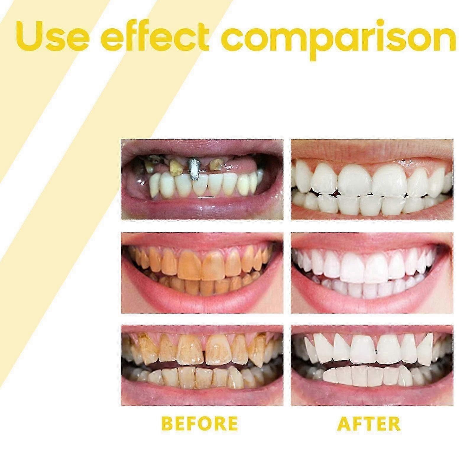 Propolis Gum Regeneration Gel
