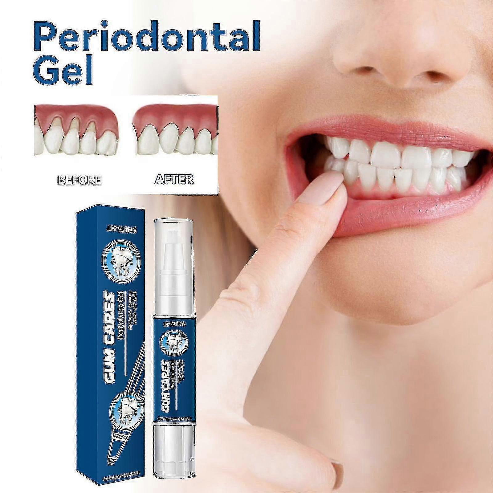 ジェイスイング ガムケアジェル ディープクレンジング 歯の汚れ、歯石、腫れ、痛みを伴うガムクレンジングジェルBF | |