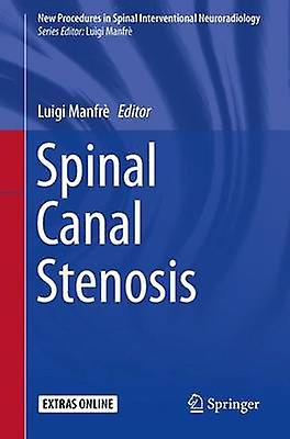 Spinal Canal Stenosis by Edited by Luigi Manfre