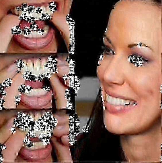 ペア上部入れ歯インスタントスマイルコンフォートフィットフレックス審美歯義歯歯トップ審美Veneer_k05