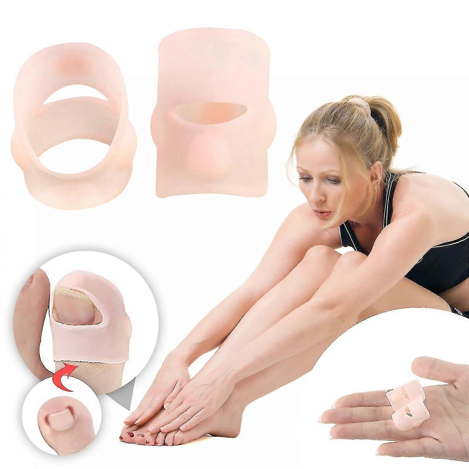 Silicone Ingrown Nail Curling Nail Correction Nail Toe Correction Device-Yvan
