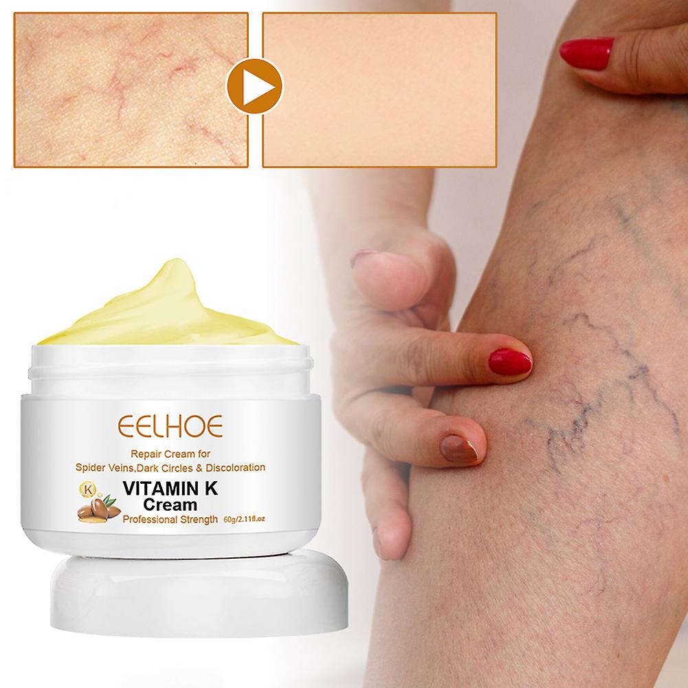 静脈瘤治療のための60gビタミンKクリームゆるい脚のための多目的静脈瘤マッサージクリーム腋窩静脈の脚