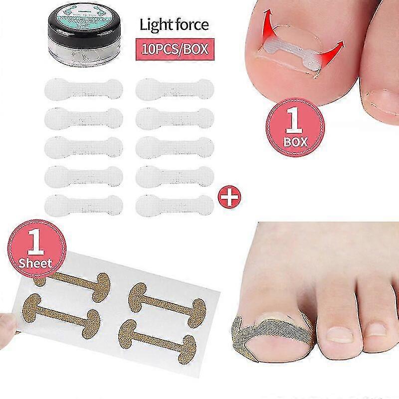 4-20pcs爪矯正ステッカー爪周囲炎治療陥入爪矯正弾性矯正クリップブレースペディキュアツール