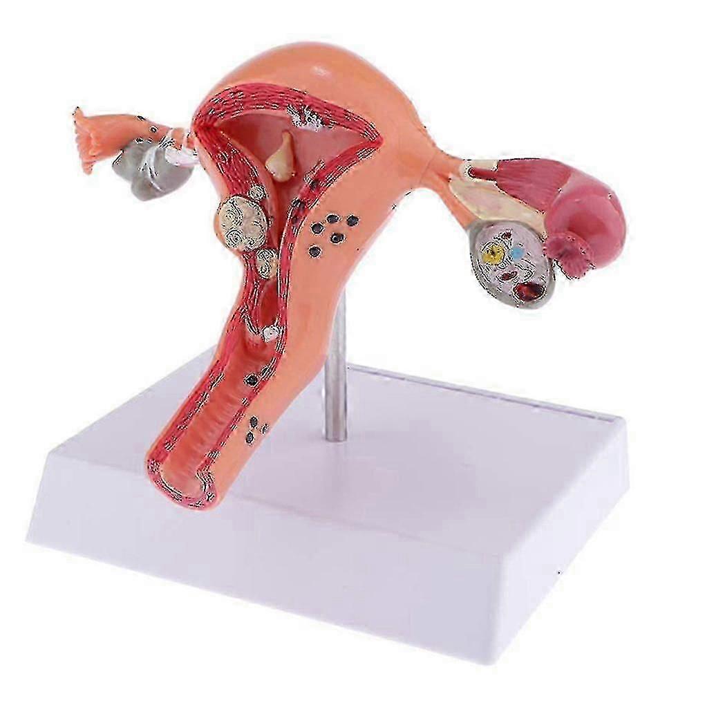 Female Uterus Structure Biological Models Educational Experiment