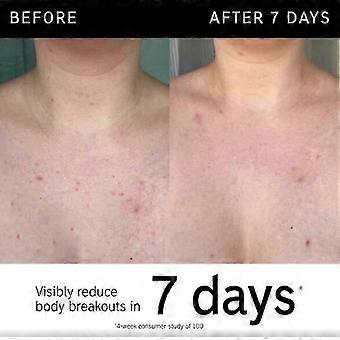 Ihr INKEY List Glykolsäure-Peeling-Stick für den Körper 45 g