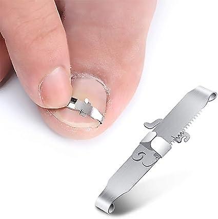 A set of ingrown nail correction tools, nail correction clips and nail bars for ingrown nails and p.