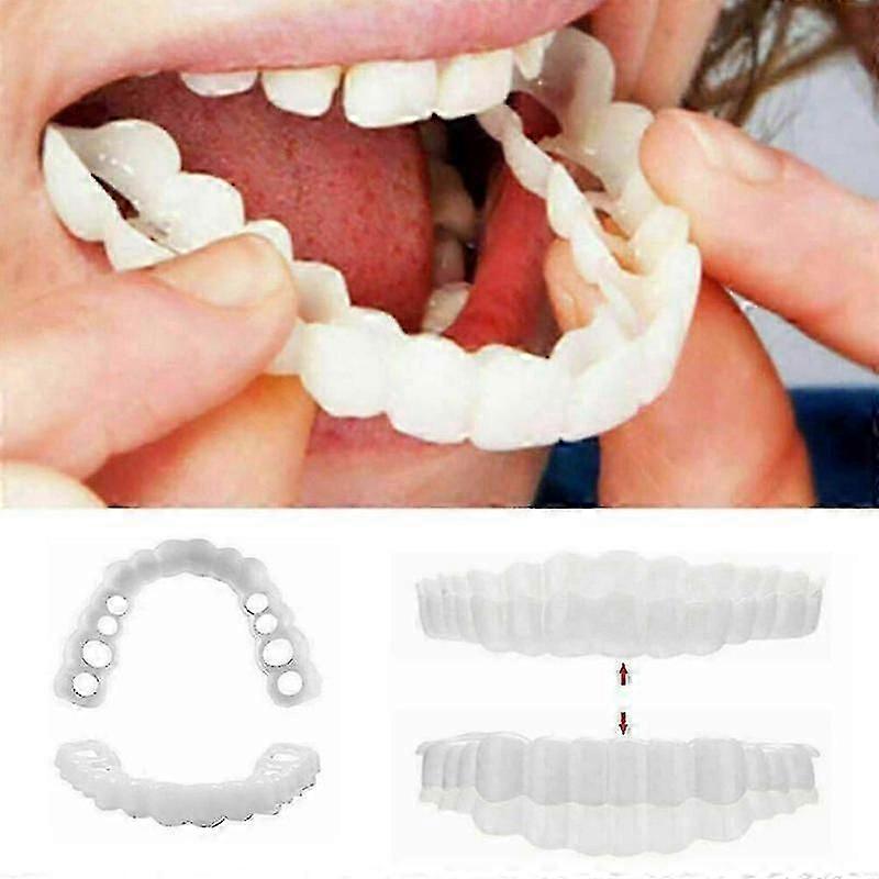 Smile Σιδεράκια Snap σε άνω και κάτω ψεύτικα δόντια οδοντική καπλαμά κάλυμμα