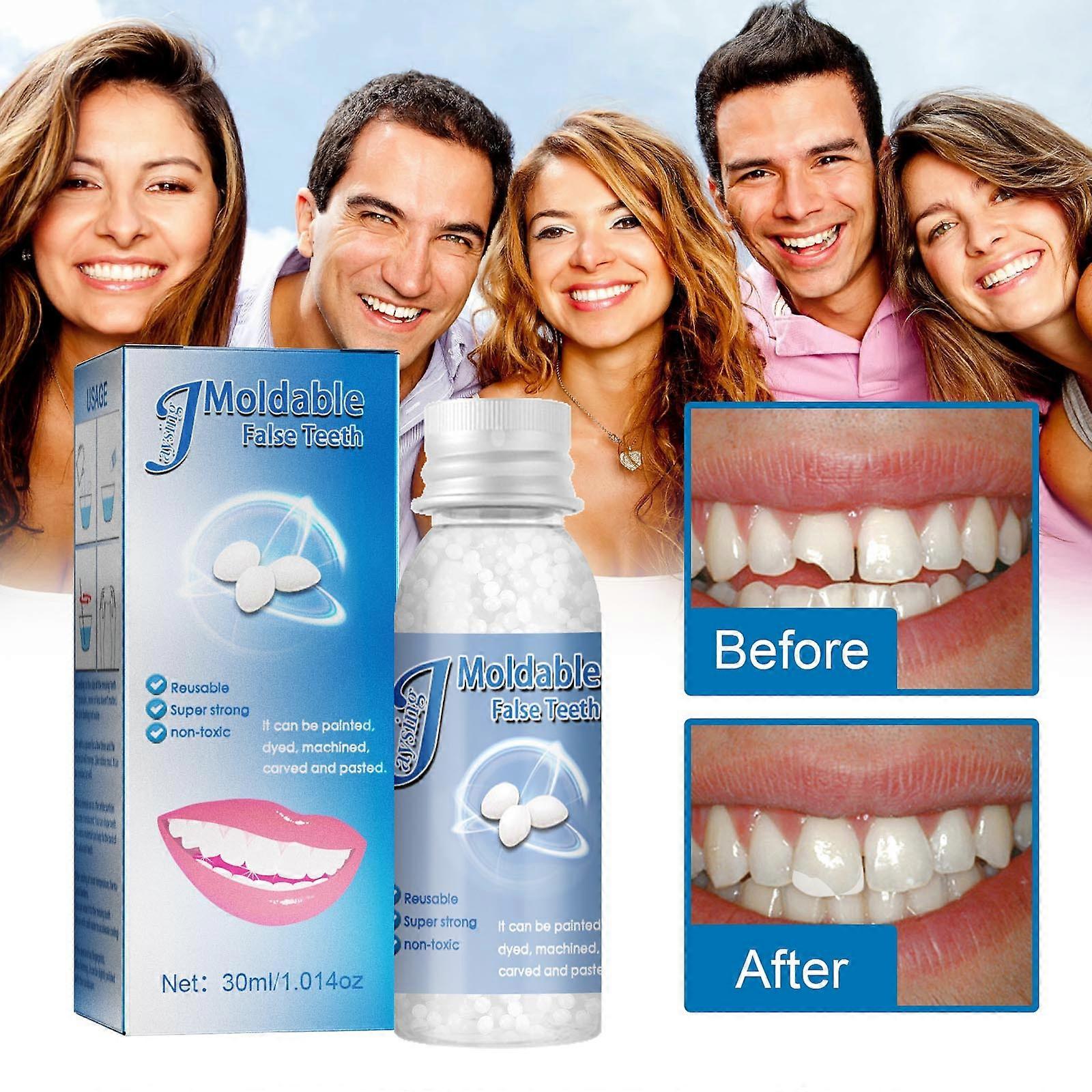 30ml Solid Glue Denture Adhesive Set Bottled Denture Solid Tooth Gel Temporary Tooth Repair Kit Teeth And Gaps False Teeth Betterlifefg