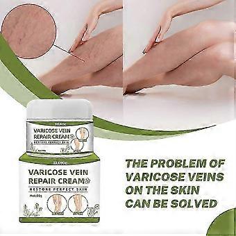 Spider Veins Treatment Effective Varicose Veins Cream.C3