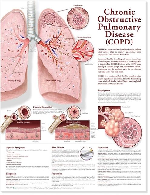 Chronic Obstructive Pulmonary Disease Anatomical Chart by Wolters Kluwer Health Wallchart Book