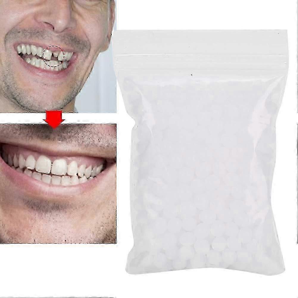 Dentures Temporary Teeth Instant Veneers Dentures Thermal Adhesive Beads Temporary Tooth Repair Set (100 g)