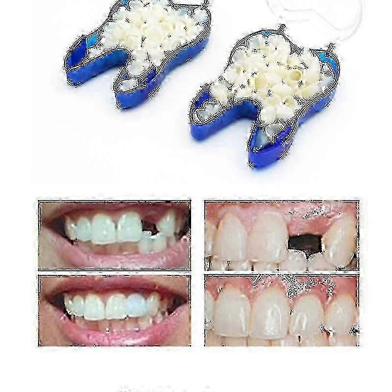 Temporary Denture Braces Occlude Upper Dentures Veneer Dentures Missing Teeth Broken Teeth Elq,z