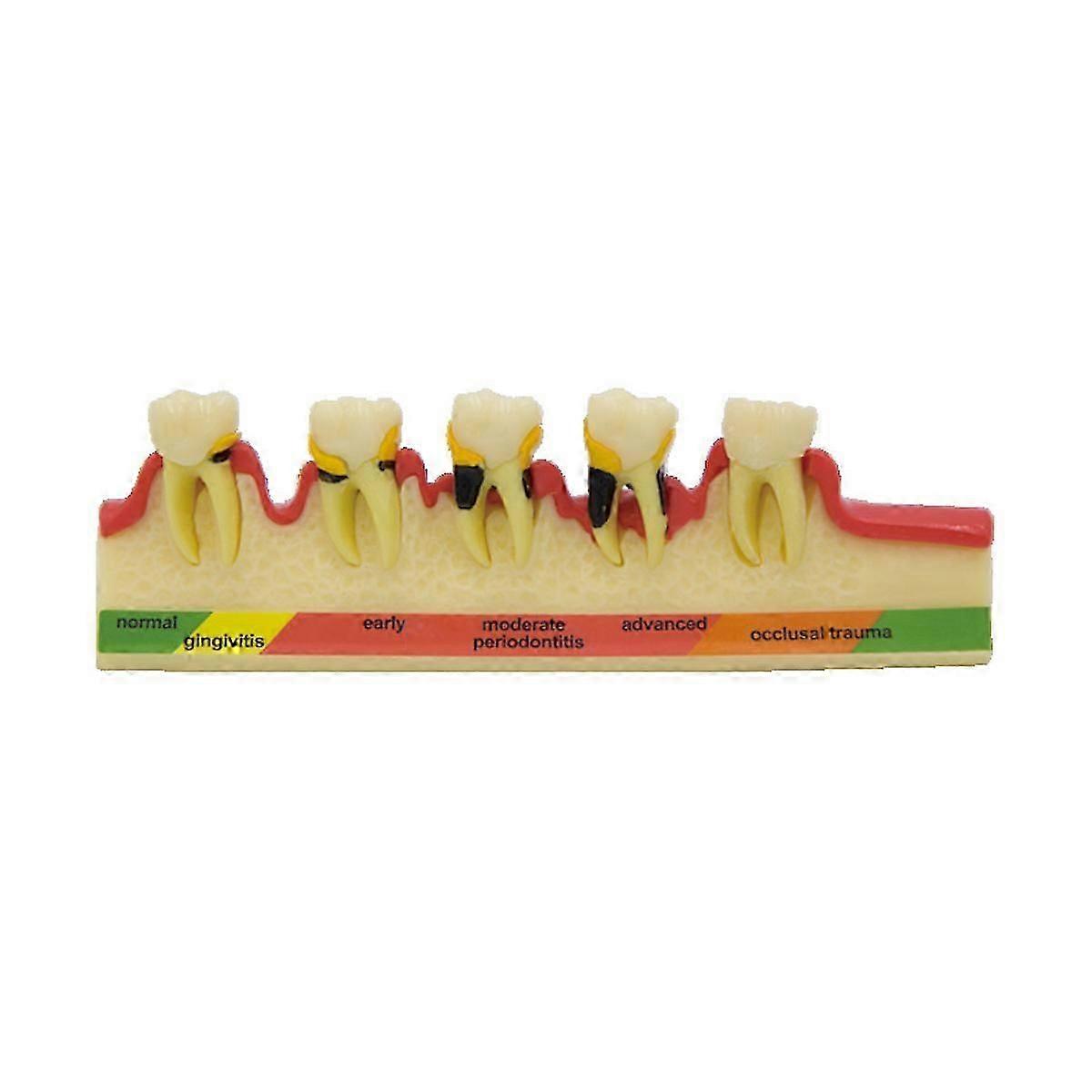 Oral Model Medical Teaching Model Tooth Peripheral Classification Model (Soft Gum)