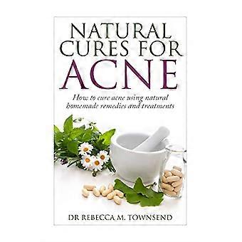 Naturliga botemedel mot akne: Hur man botar akne med hjälp av naturliga hemgjorda botemedel och behandlingar (Acne Cure, Acne Treatment, Acne No More)