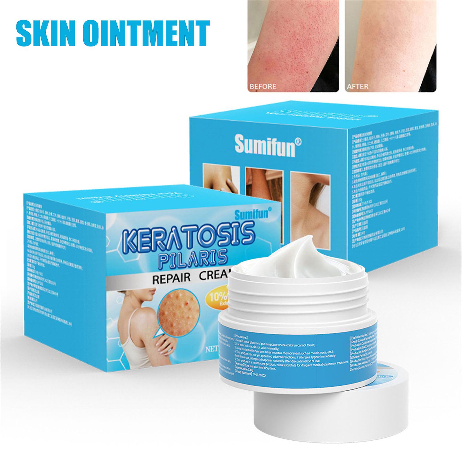 30g Keratosis Pilaris Lotion Fast Effective Relief Restoring Body