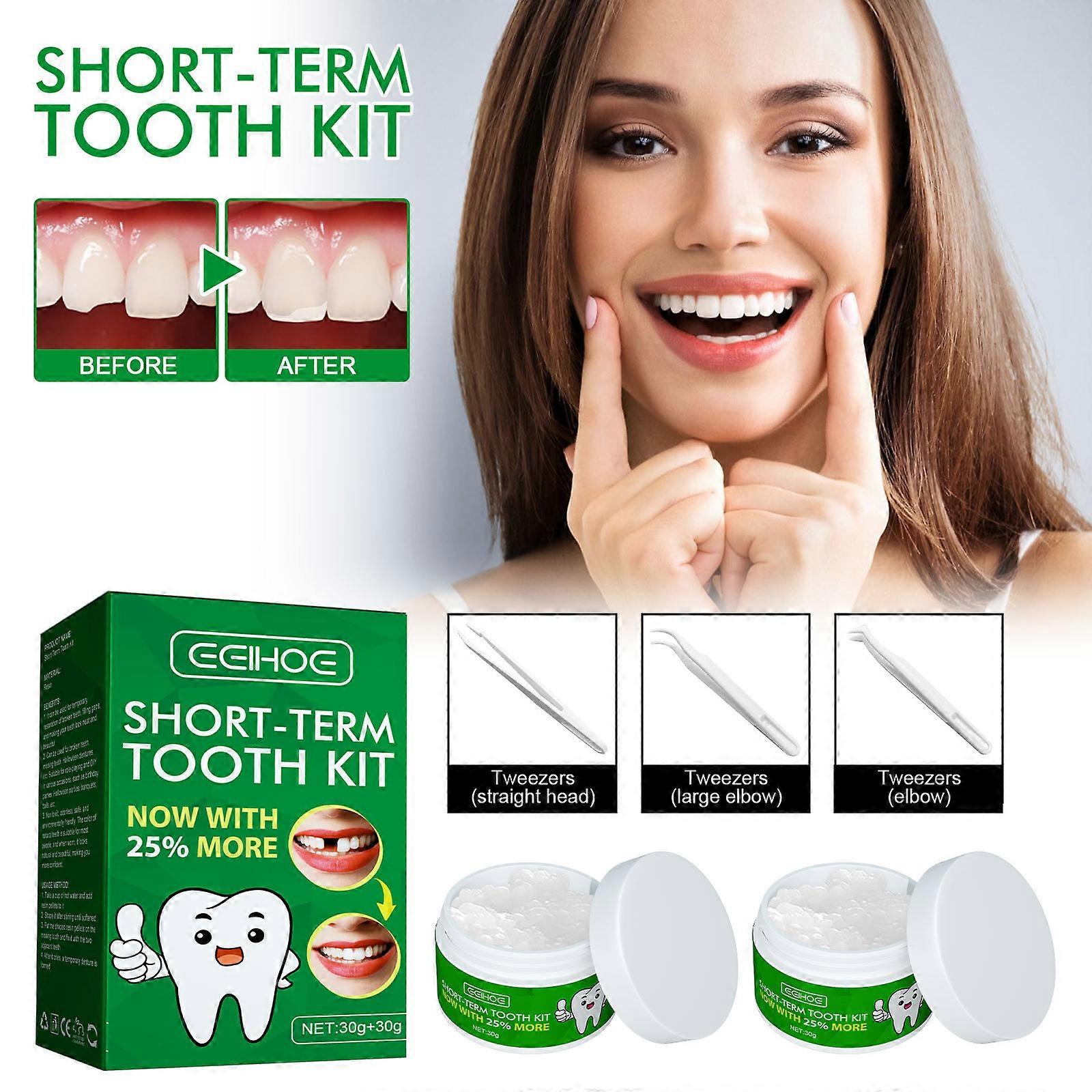 Temporary tooth kit for film and television dances, modified dentures, temporary fillings, gap fillings, plastic teeth glue, temporary tooth kit