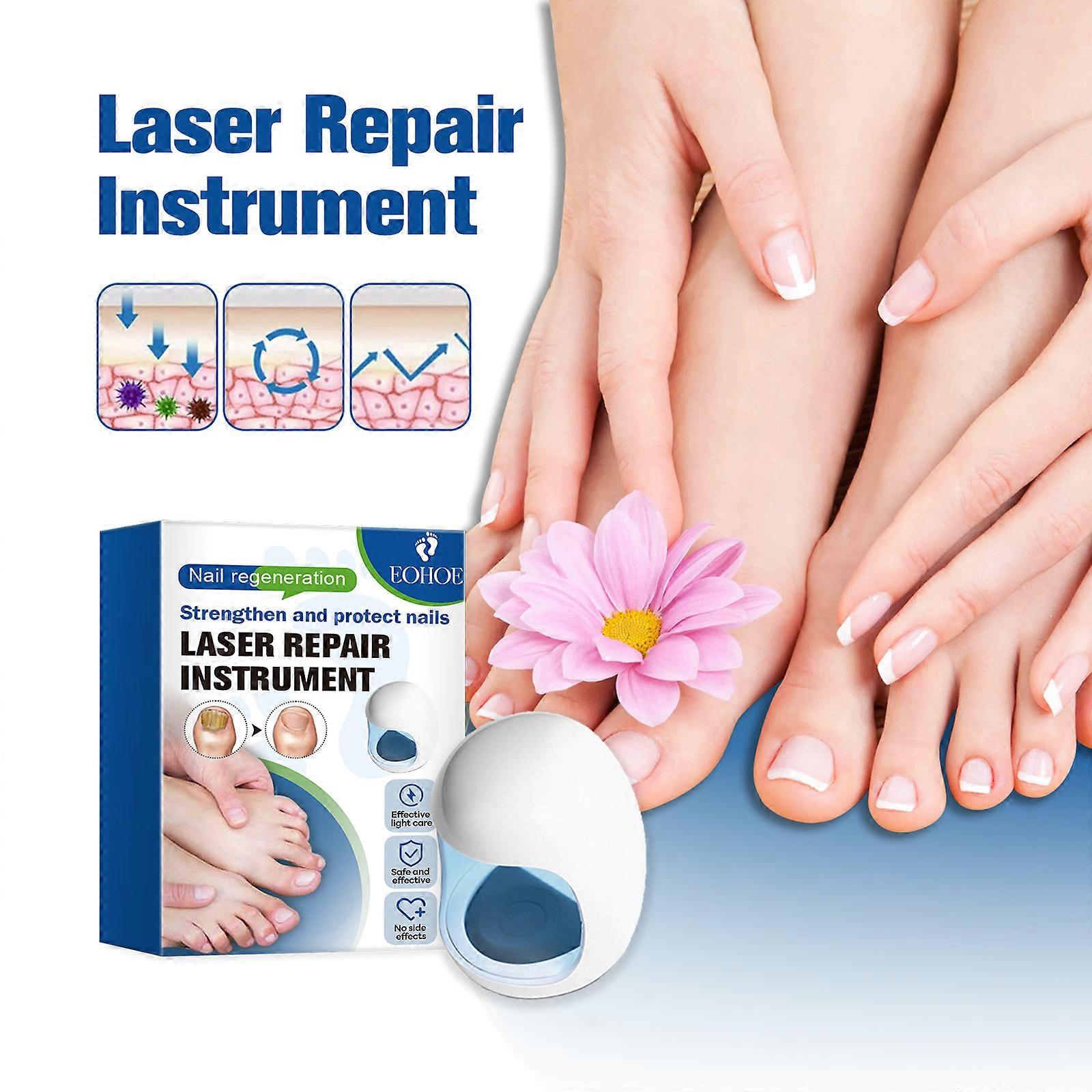 Neglesvamp rengøring laser enhed til onychomycosis, neglesvamp laserbehandling for fingernegle og tånegle LED lysterapi enhed