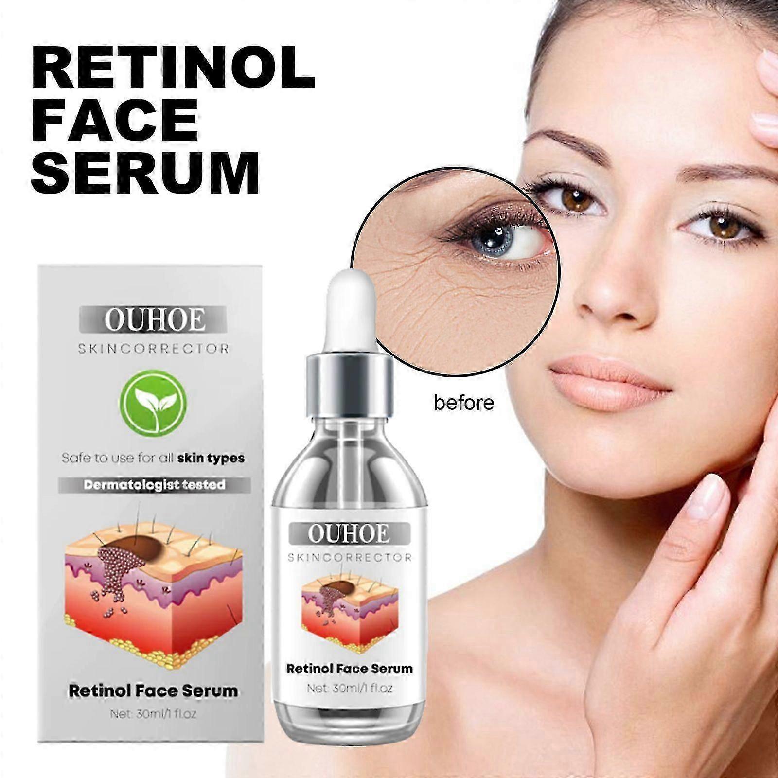 Retinol Face Serum - ryppyjä ehkäisevä, tahroja vaalentava ja kiinteyttävä esanssi aloella ja C-vitamiinilla