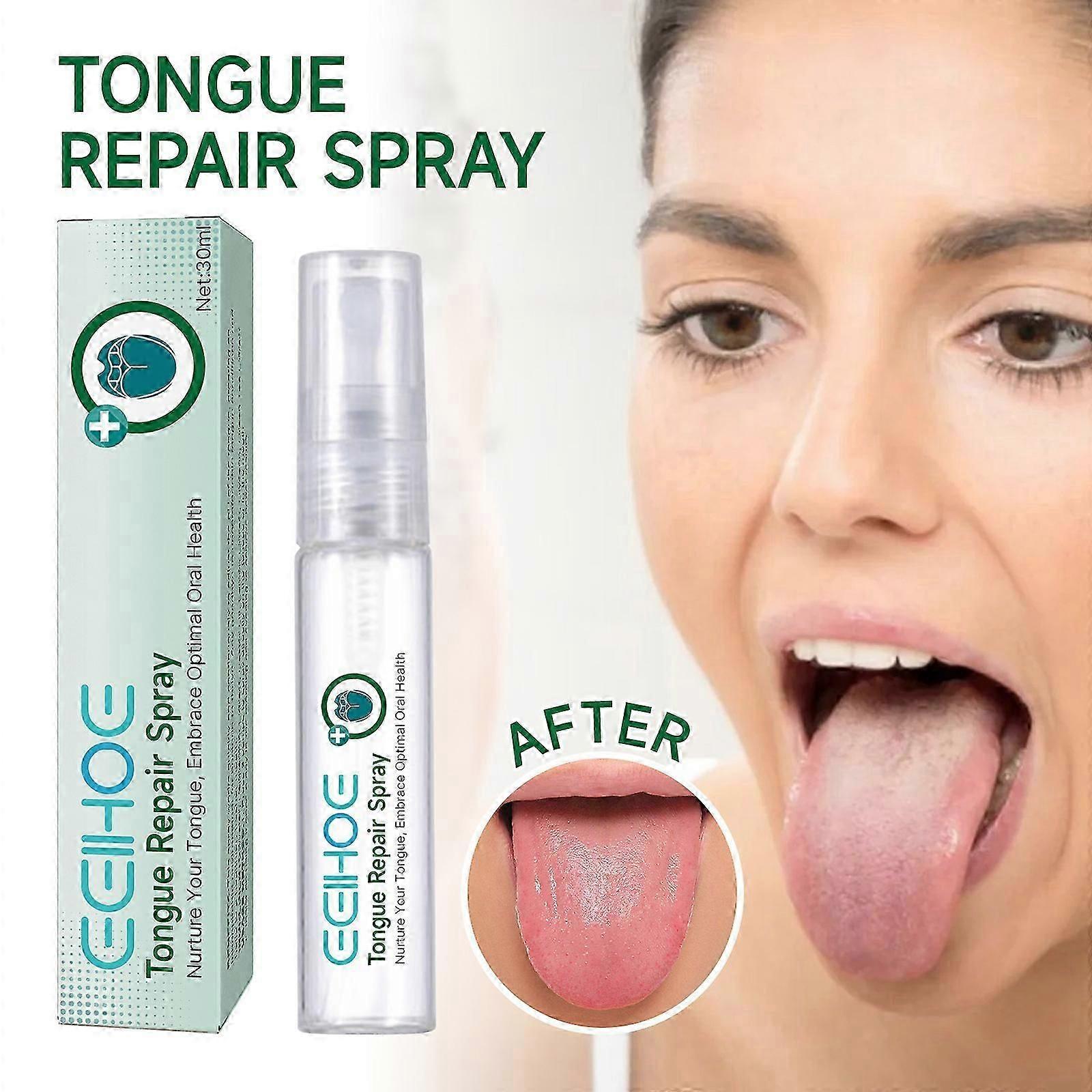 Tungereparationsspray 30 ml Reducerer hævelse Tungelindrende behandlingsspray mod dårlig ånde, Tungereparationsspray mod tørhed og dårlig ånde