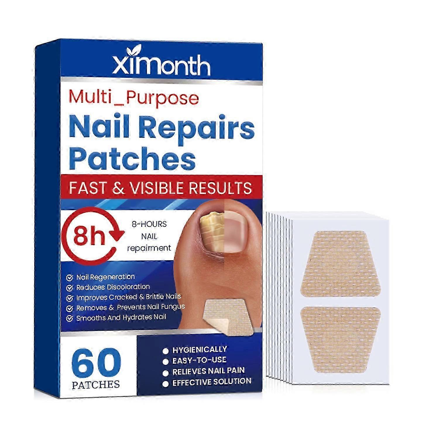 Ximonth Patch Επισκευή Νυχιών, Χέρια Και Πόδια Μαλακό Ένθετο Νυχιών Πάχυνση Νυχιών Φωτεινό Καρφί Αυλάκι Γκρι