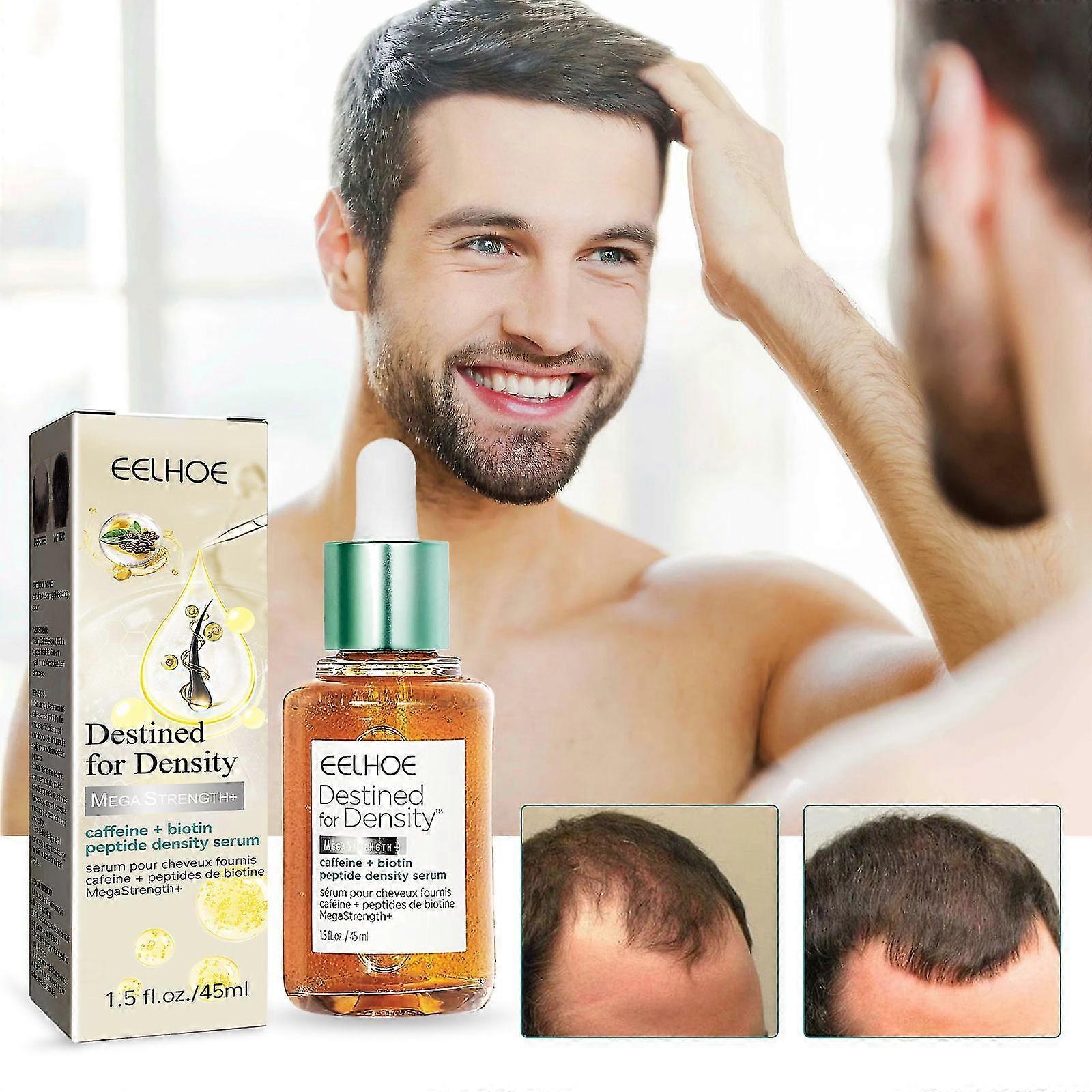 Olejek eteryczny do wzrostu wosw Utrwalanie wosw Anti-loss i gsto Zwikszanie wzrostu wosw Pielgnacja wosw Olejek eteryczny Mikkie wosy