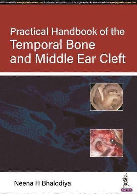 Practical Handbook Of The Temporal Bone And Middle Ear Cleft by Neena H Bhalodiya Paperback Book