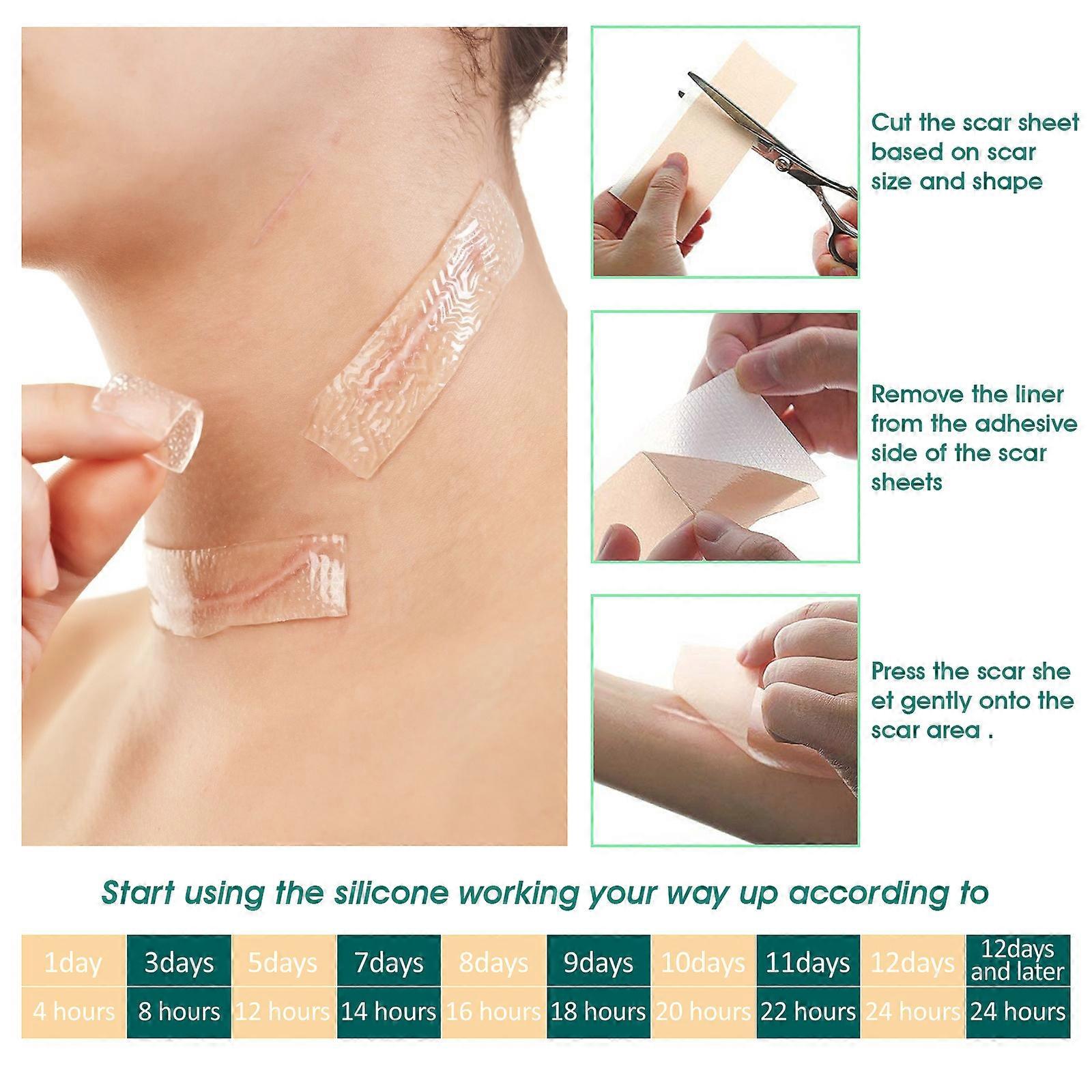Clear dressing to help make scars flatter, softer and lighter, adhesive dressing, scar reducer