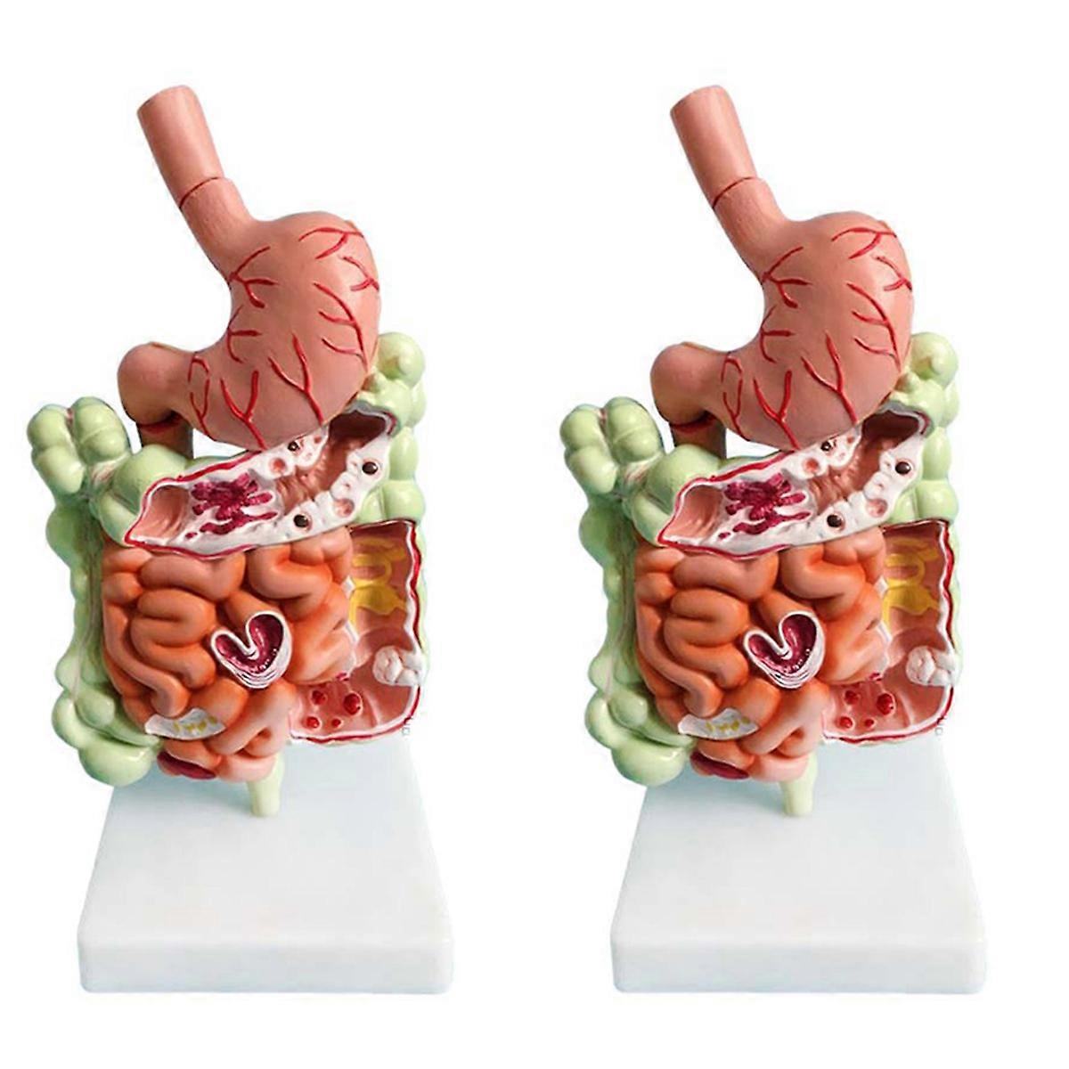 Modèle du système digestif humain Anatomie de l'estomac Gros intestin Cæcum