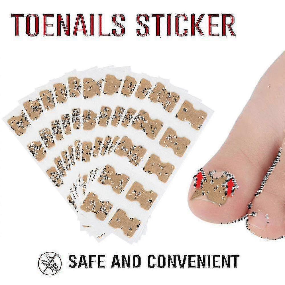 10pcs Toenail Correction Patch Glue Free Pedicure Tools Toe Nail Ingrown Patch Corrector