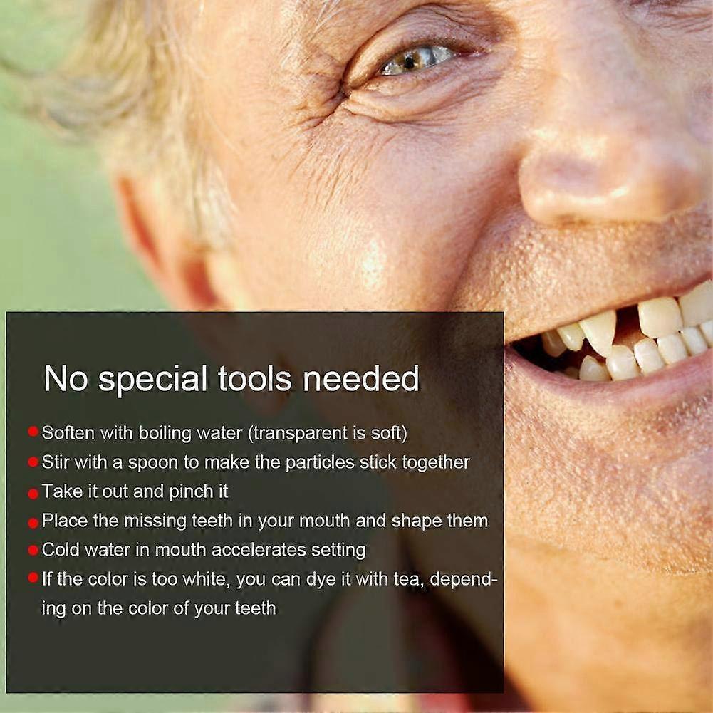 Prosthetic Teeth Multifunction Temporary Tooth Repair Set for Missing Tooth Instant Veneer Dentures 4g Temporary Tooth Repair