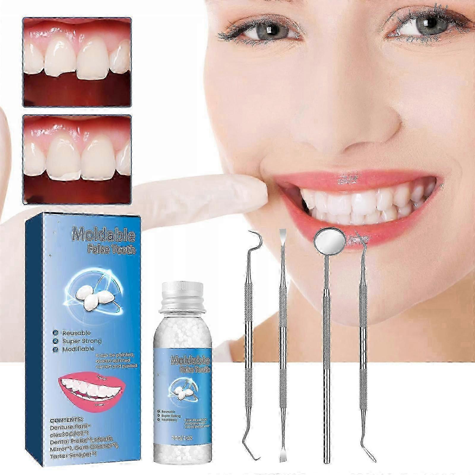 Tooth Filling Repair Kit, Moldable Tooth Replacements Kit Temporary Fixing Missing and Broken Teeths for Confident Smile