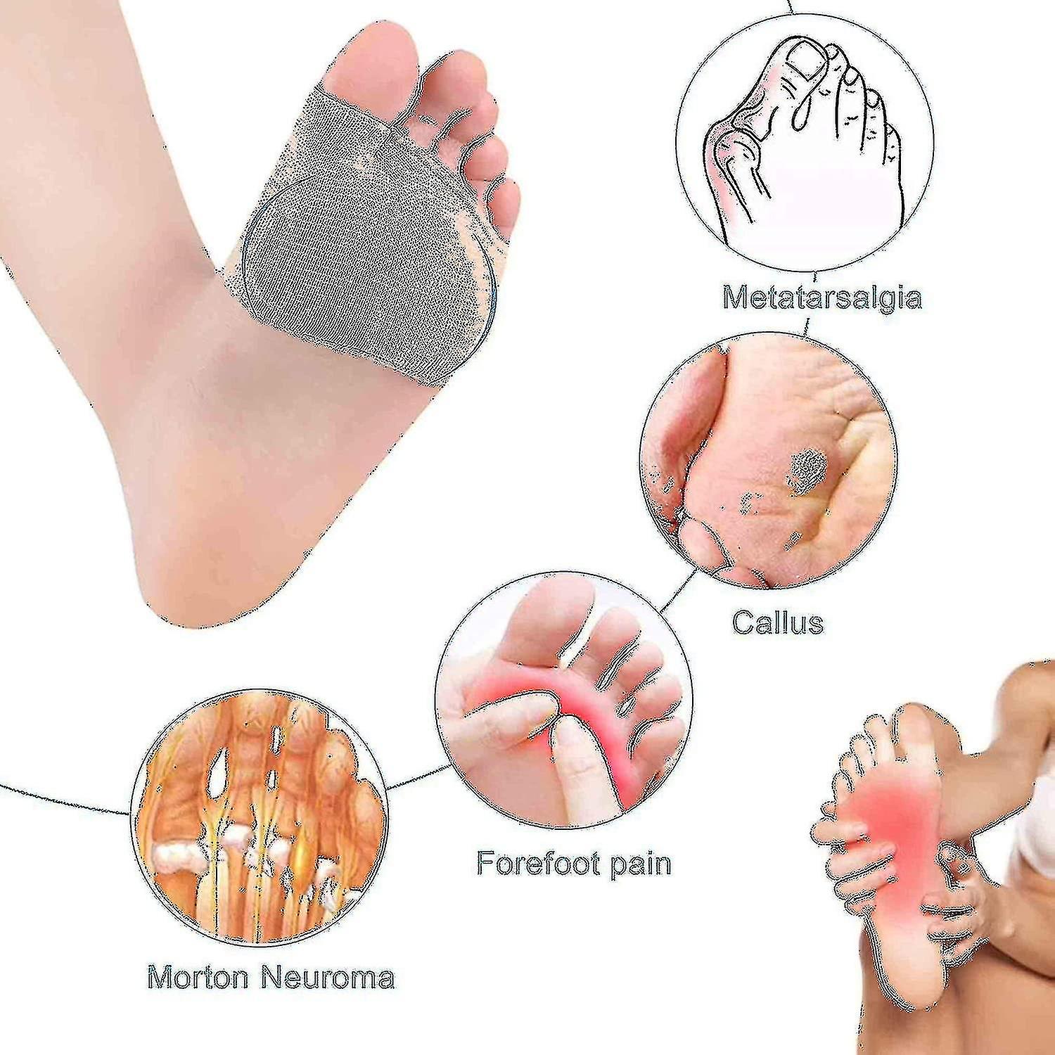 Metatarsal Pads Metatarsalgia Morton Neuroma Sesamoiditis Pain Ref