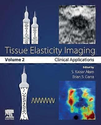 Weefsel elasticiteit Beeldvorming