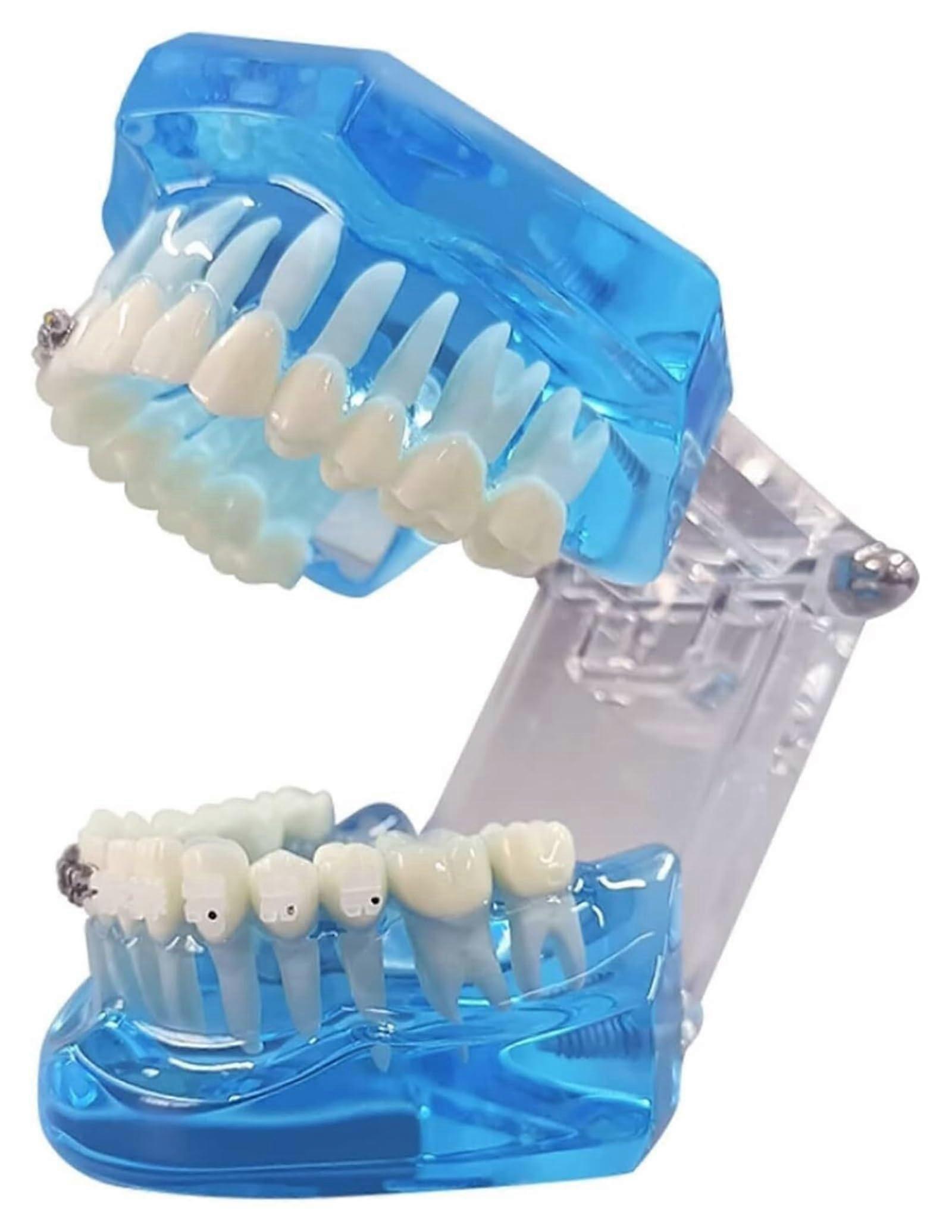 Transparent Tooth Model with Clear Internal View for Dental Teaching and Orthodontic Classroom Display
