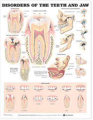 Disorders Of The Teeth And Jaw Anatomical Chart by Wolters Kluwer Health Wallchart Book