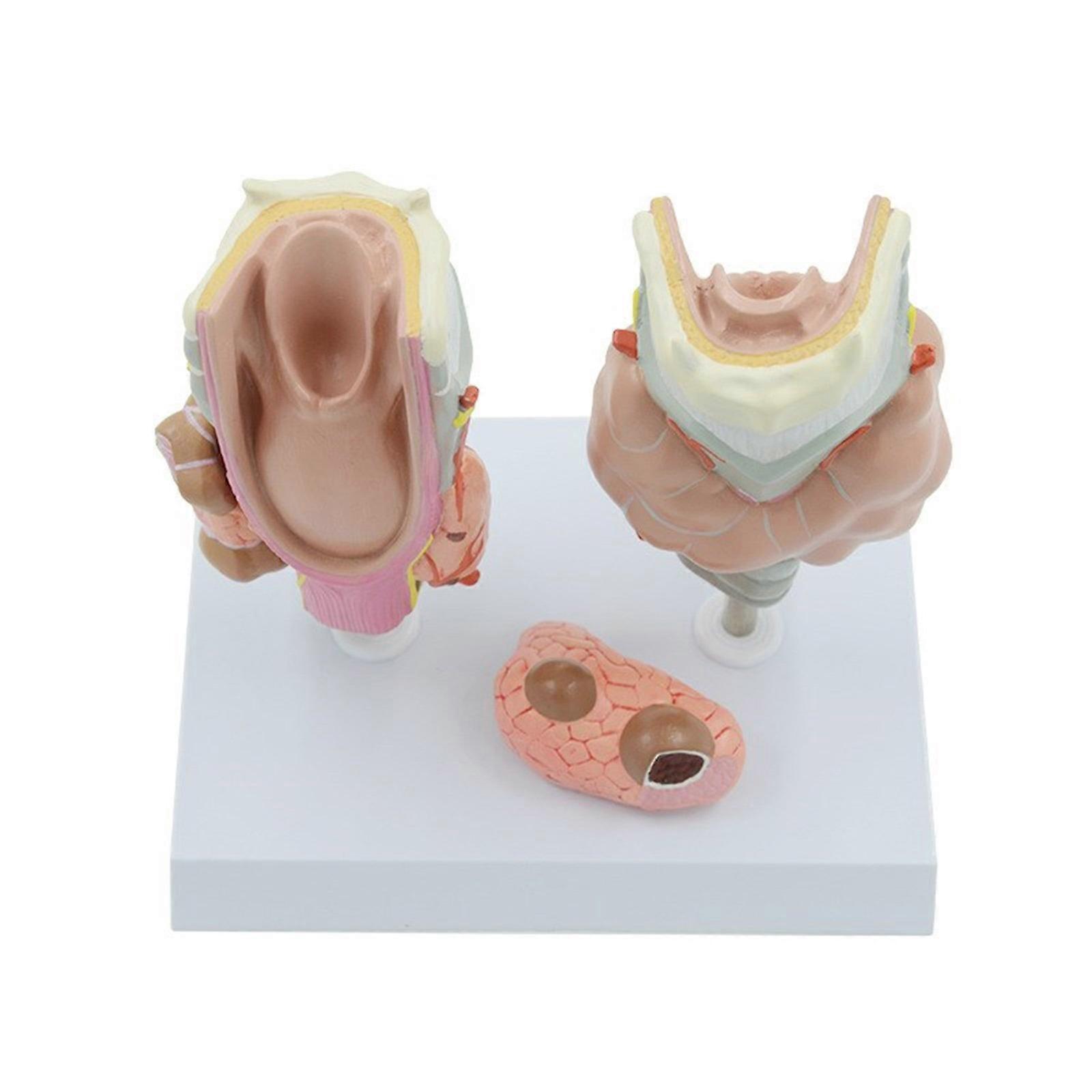 Anatomical Pathological Thyroid Gland Model, Realistic Pathological Thyroid Anatomy Model Human Organ Model