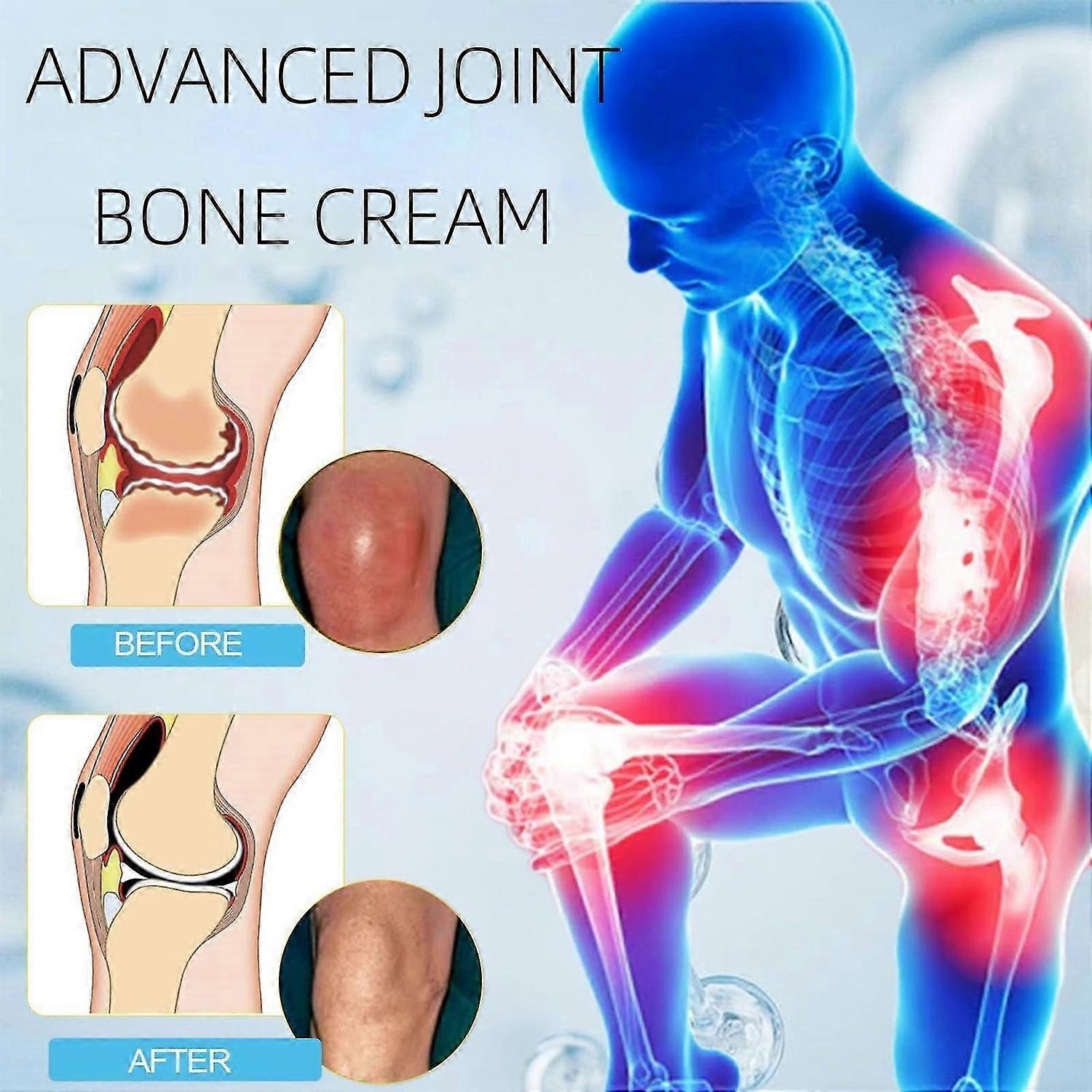 ヒアルロン酸関節クリーム、ヒアルロン酸関節修復マッサージクリーム、背中、首、手、膝用の高度な関節と骨のケアクリーム