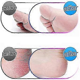Grobe Ersatzrollen für Emjoi Micro Pedi - 4er Set