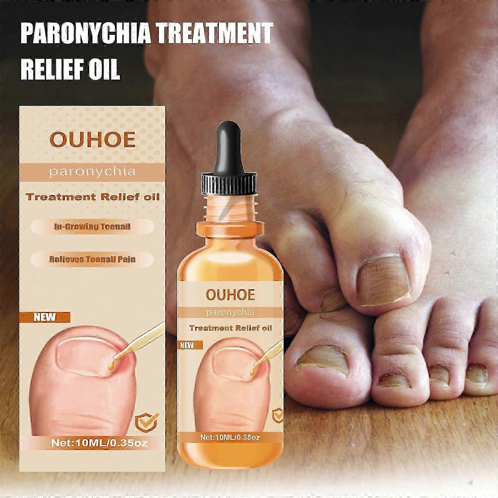 Anti-Nail Groove Relief Oil