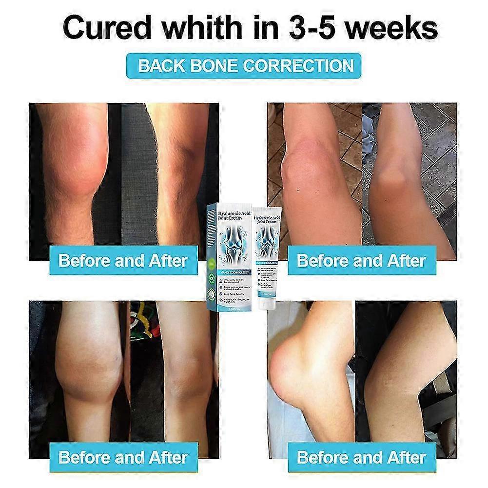 كريم التهاب المفاصل للركبتين والظهر يخفف الآلام ويخفف من التصلب كريم تدليك للاستخدام الخارجي
