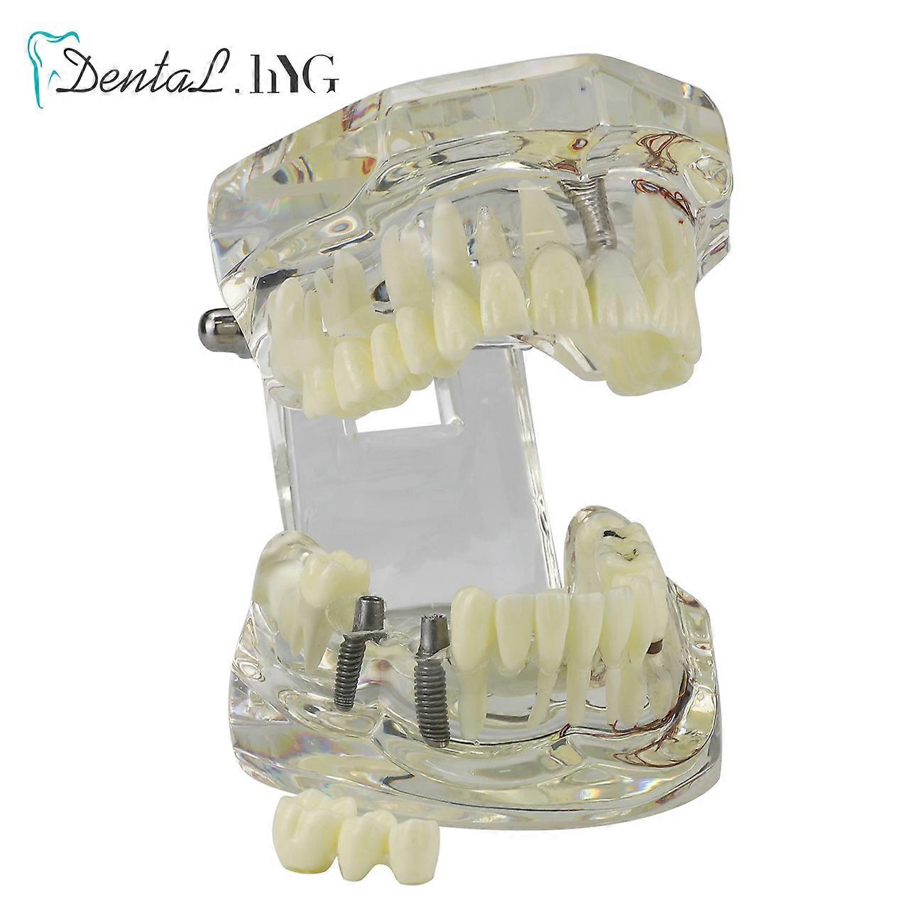 Νευρωνική Επισκευή Δοντιών Οδοντικό Εμφύτευμα Παθολογικό Μοντέλο Φοιτητές Οδοντιάτρου Επικοινωνία Μάθηση Έρευνα Διδασκαλία Στοματικών Παθήσεων