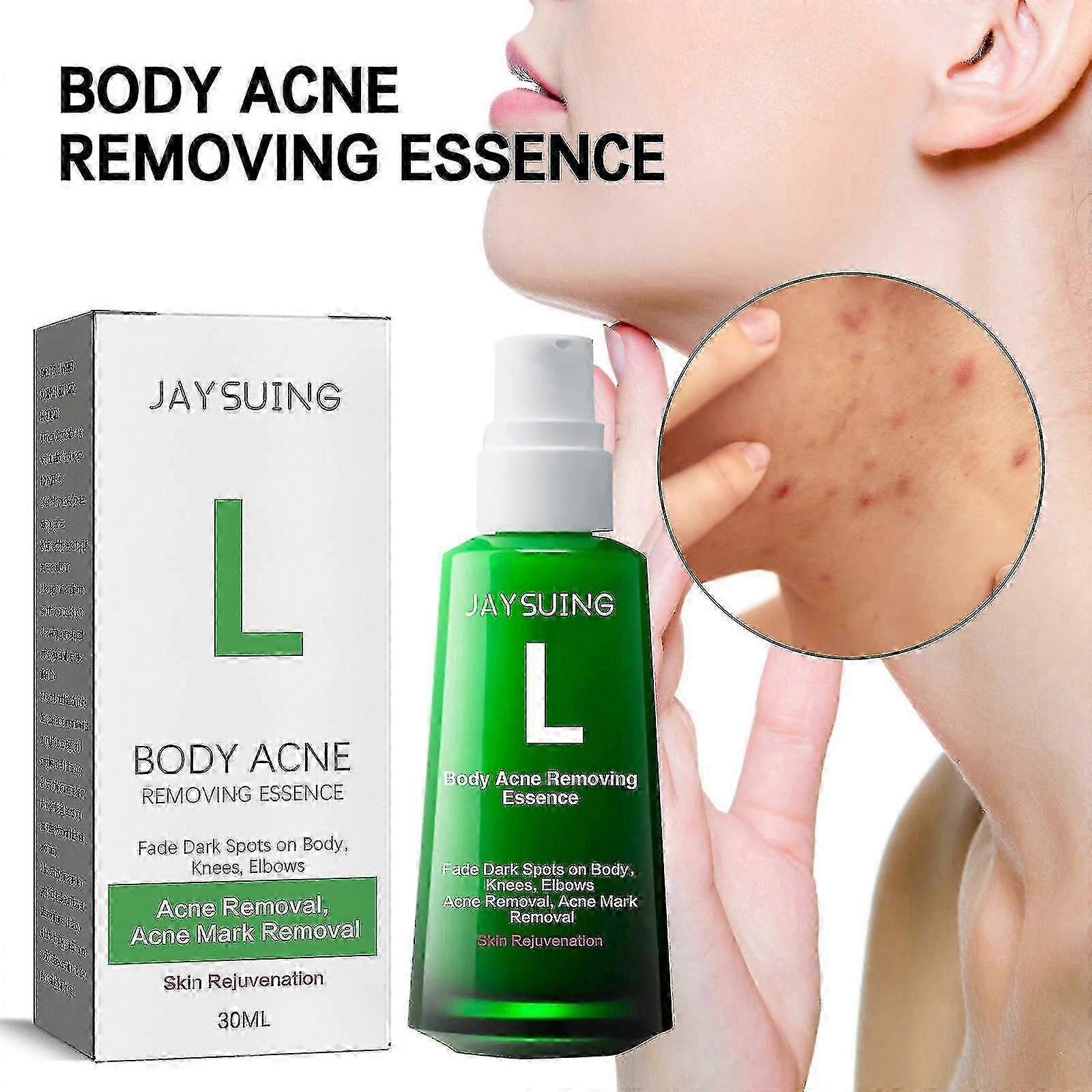 ジェイスイング アンチ ニキビ ホワイトニング エッセンス フェード ニキビ跡や跡 保湿 ホワイトニング スキンケア エッセンス BF |