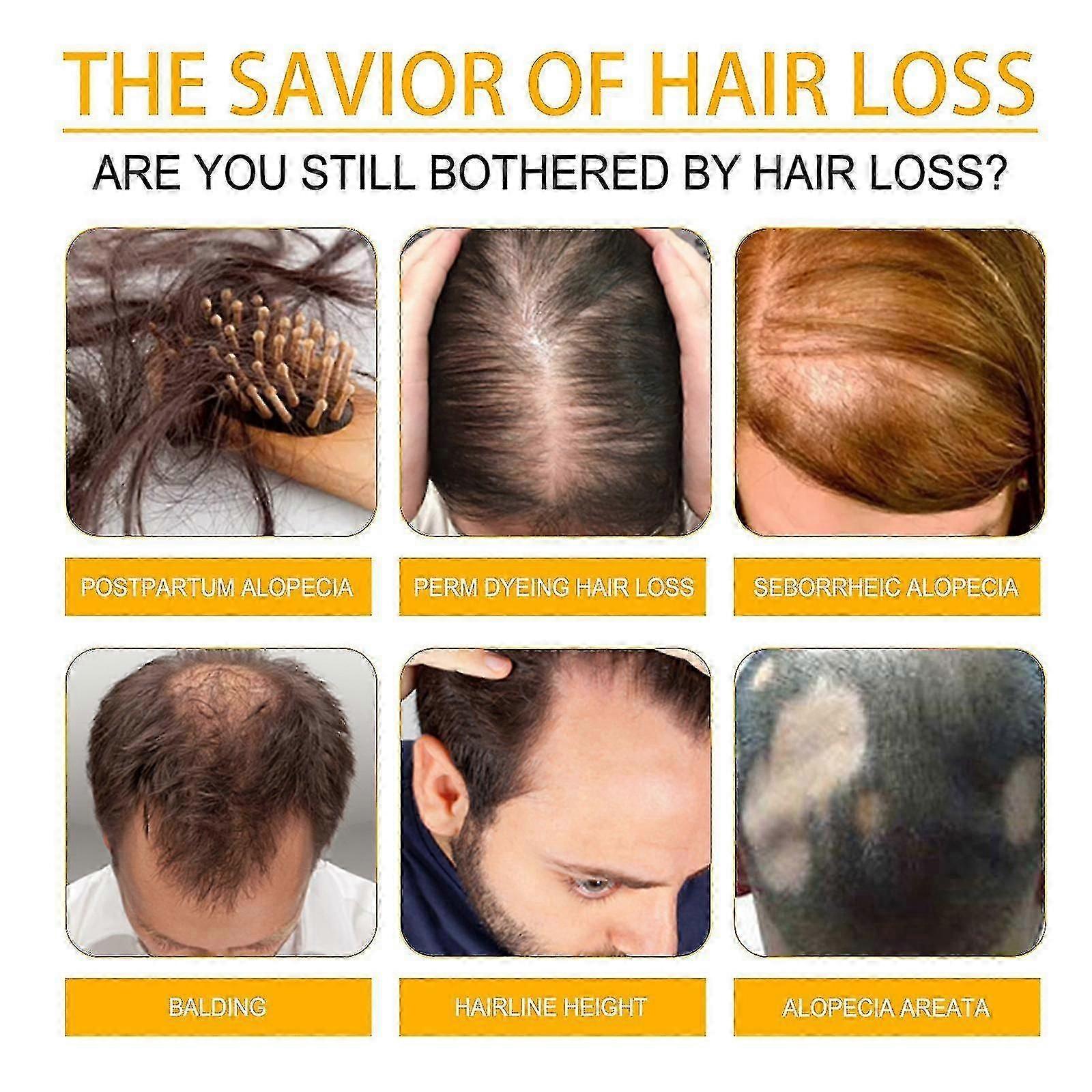 ビオチン育毛スプレーストロングヘアマッサージ頭皮密ヘアソリッドヘアアンチロスヌーリ