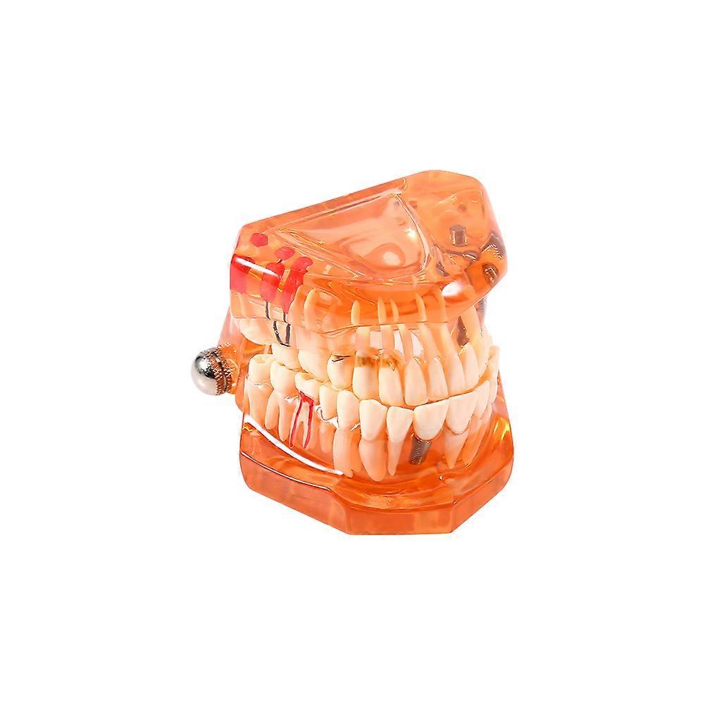 1pc Orange Color Dental Disease Removable Study Teaching Teeth Model