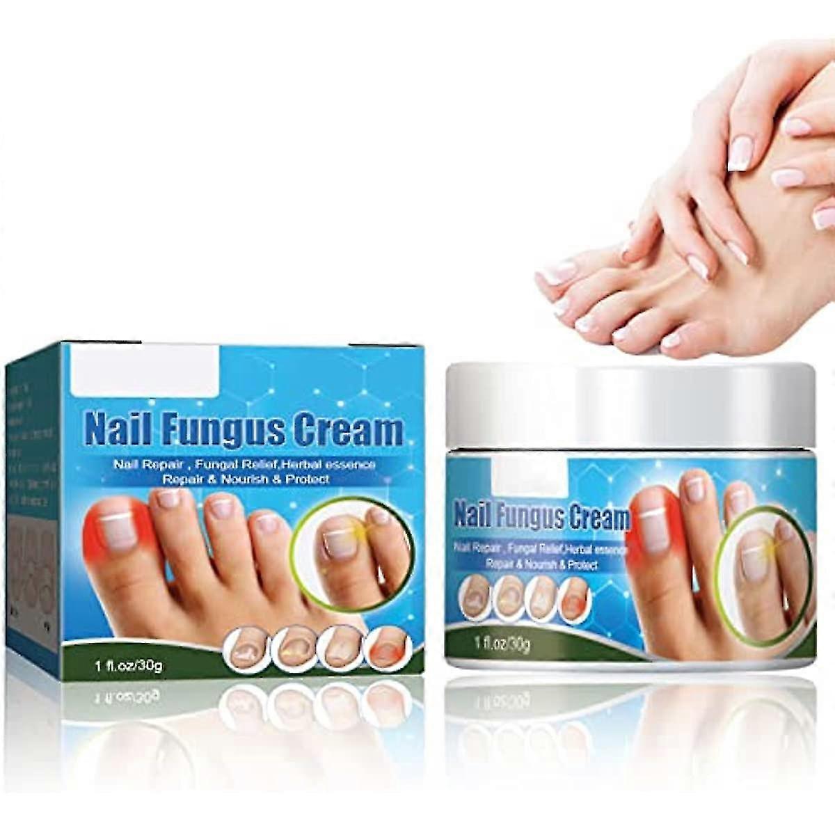 Neglesvamp Behandling Cream 30g Stærk Anti-svampe negle behandling For tåneglesvamp Svampe negle behandling for atlet s fod og negle infektioner Re