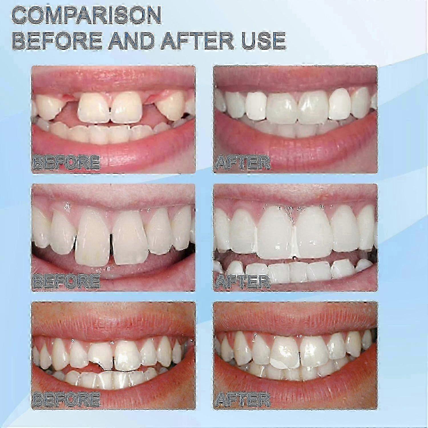 Moldable White Teeth Particles 30ml