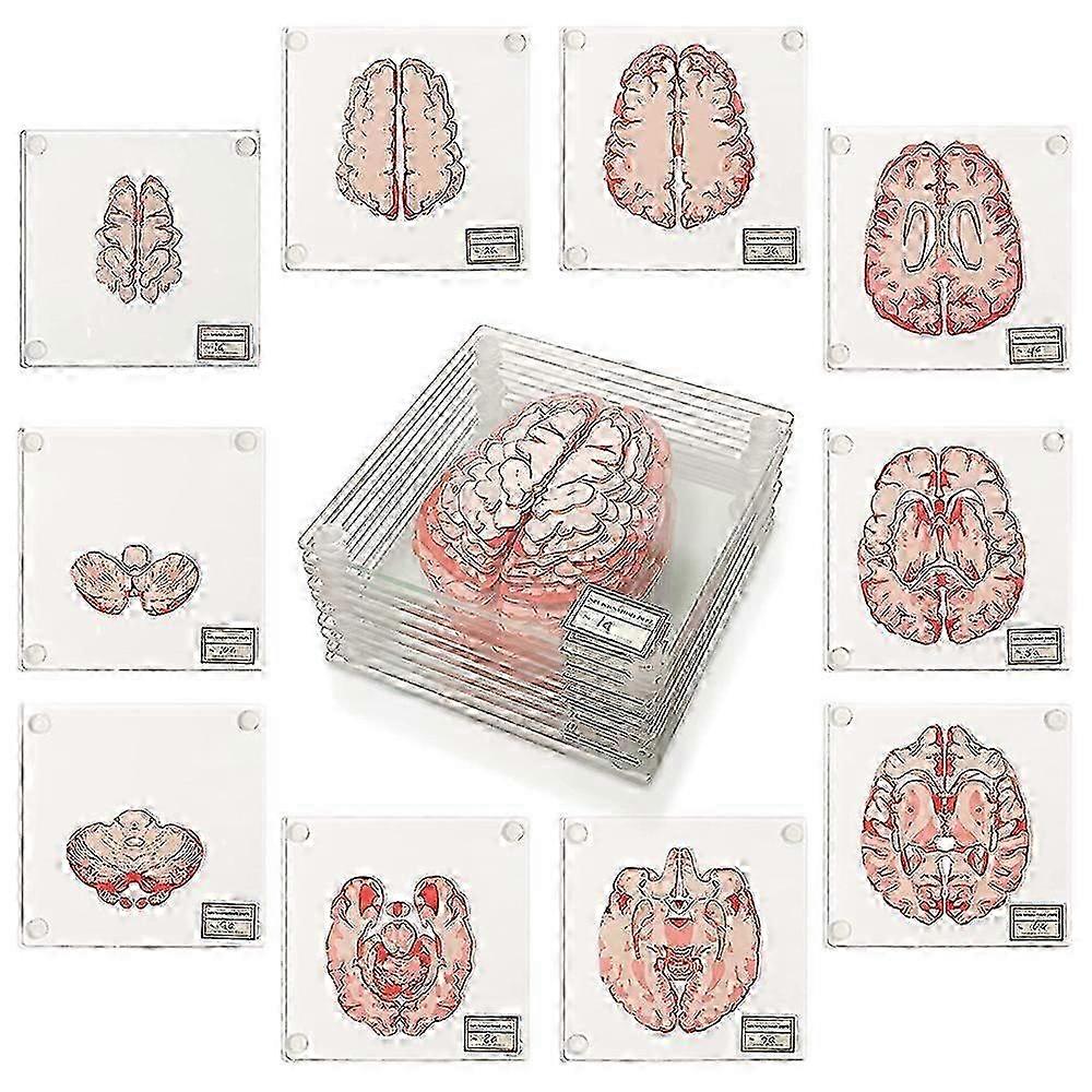 Full Brain Glass Coaster Set