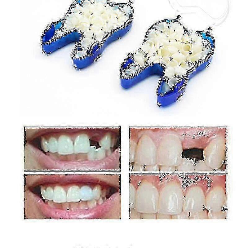 Temporary Denture Braces for Missing Teeth & Broken Teeth Occlusion Solution_DJ