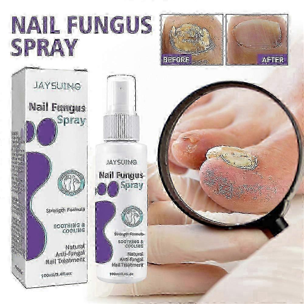 Nail Care Solution, 2pcs 100ml, Soft Nail, Yellow Care