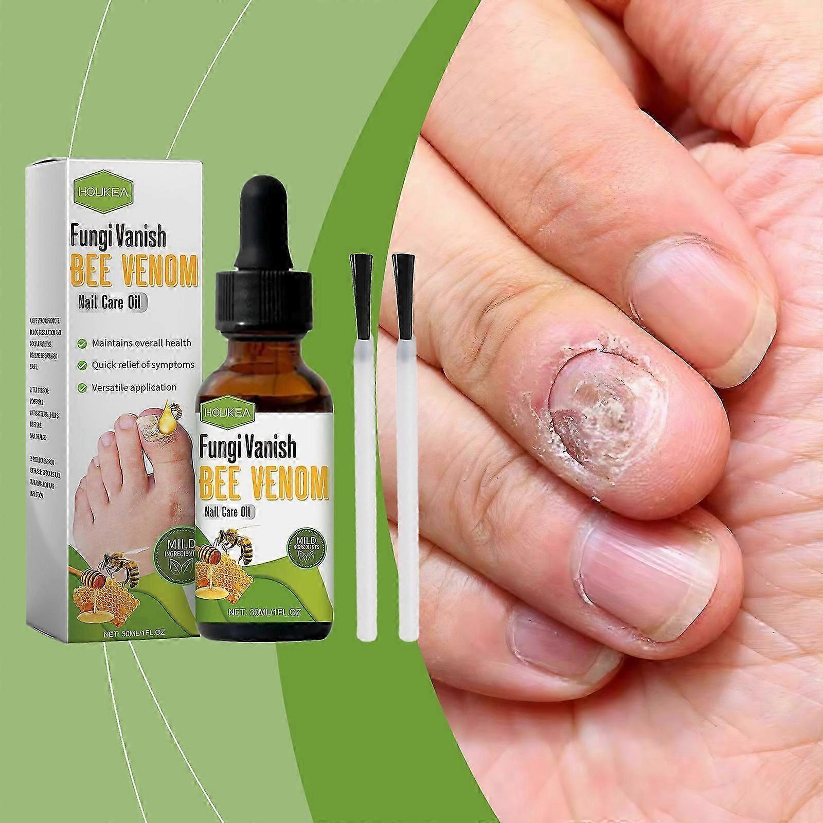 Bee Venom nail care oil, gentle repair of soft nails, thick nails, inlaid nails and empty nails, glossy nail solution, effective against fungi